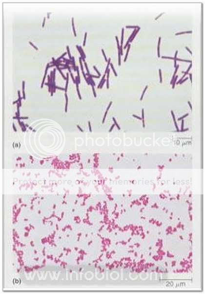 Los dos tintes de las bacterias de Gram